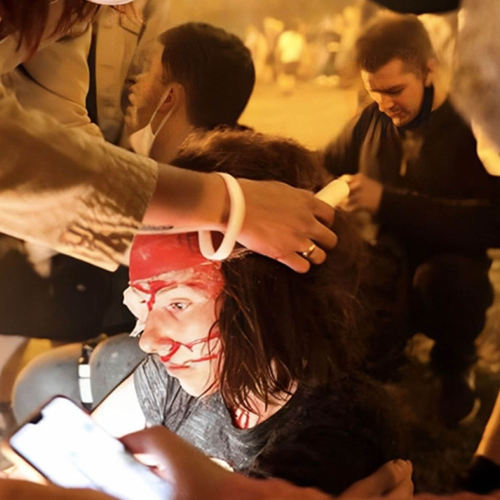 Image showing Belarusian protester with bloodied face