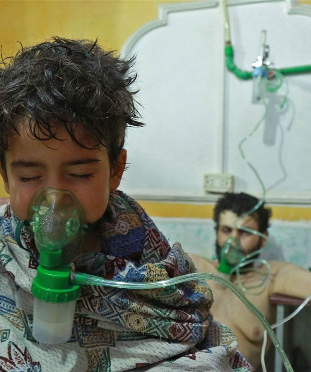 Chlorine gas symptoms reported in eastern Ghouta, Syria