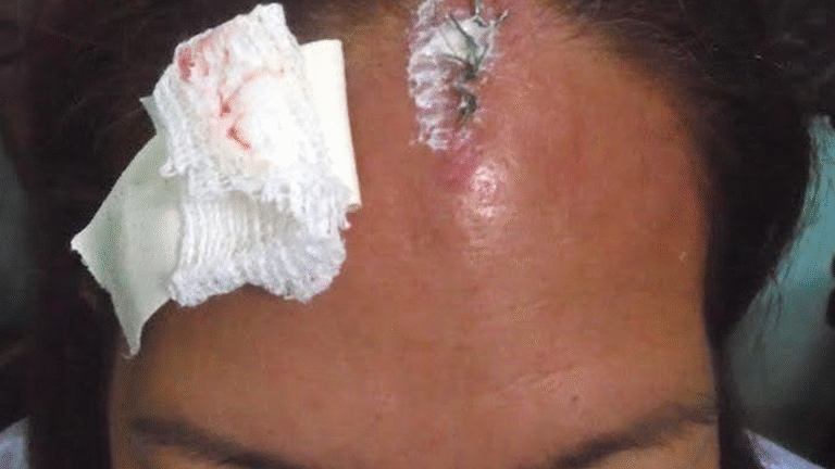 Cuba: Female Activists Beaten, Stripped Naked By State Agents